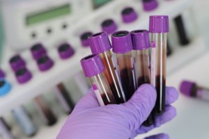 A close up of a hand in a purple glove holding five blood vials with purple caps for an ingredient trend article on blood themed consumer products
